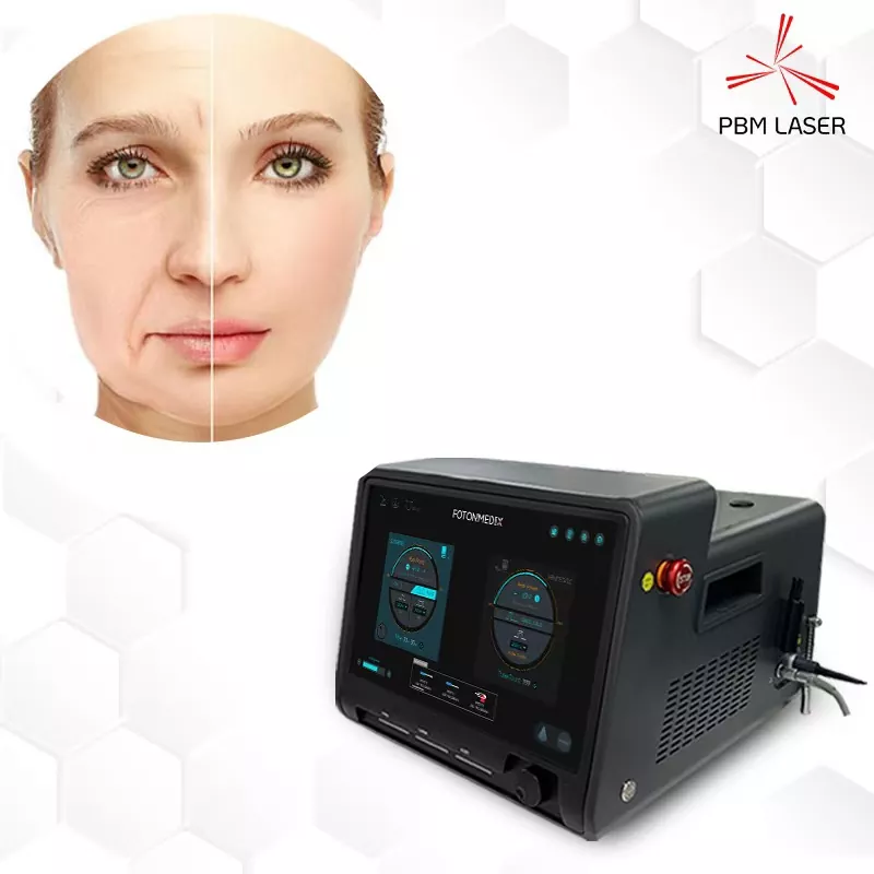 Lazerinė chirurgija dermatologijoje